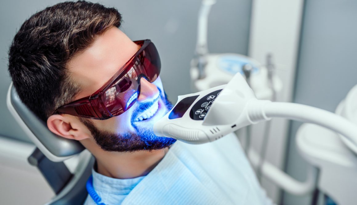 Four things to consider if you’re trying to decide between at-home or dental clinic whitening.