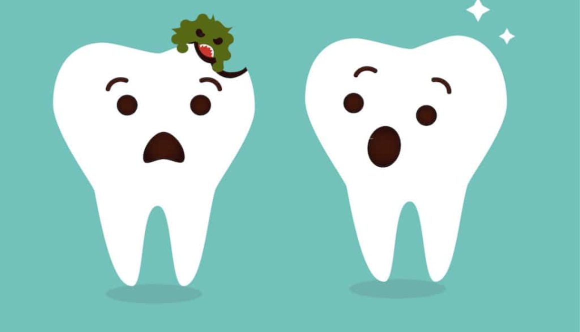 how-to-prevent-cavities