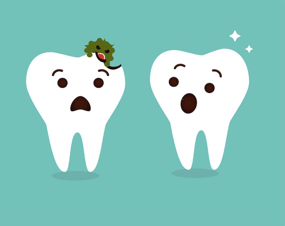 how-to-prevent-cavities