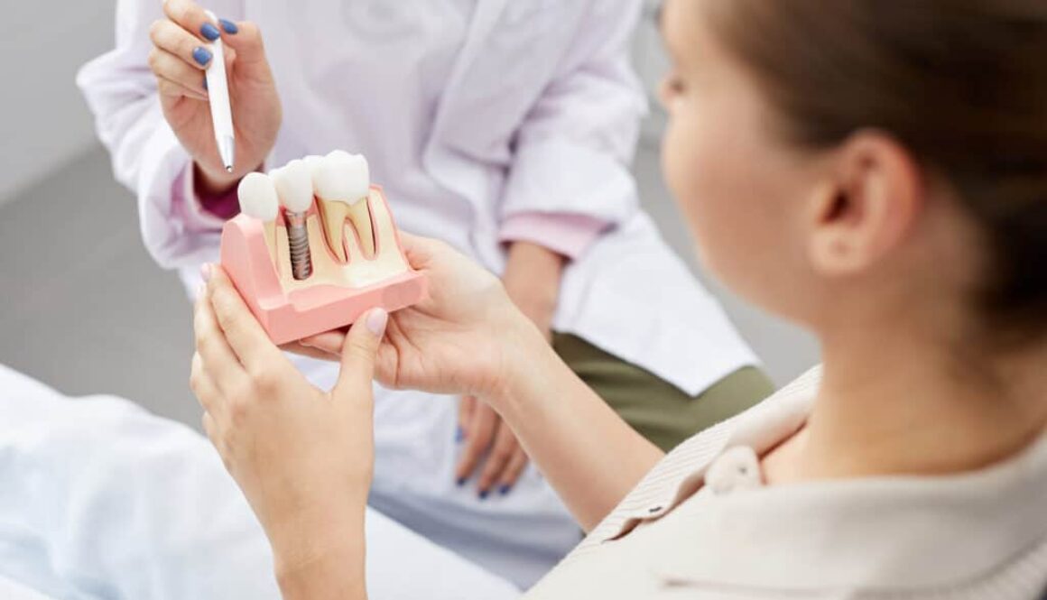 what-you-should-know-about-dental-implants
