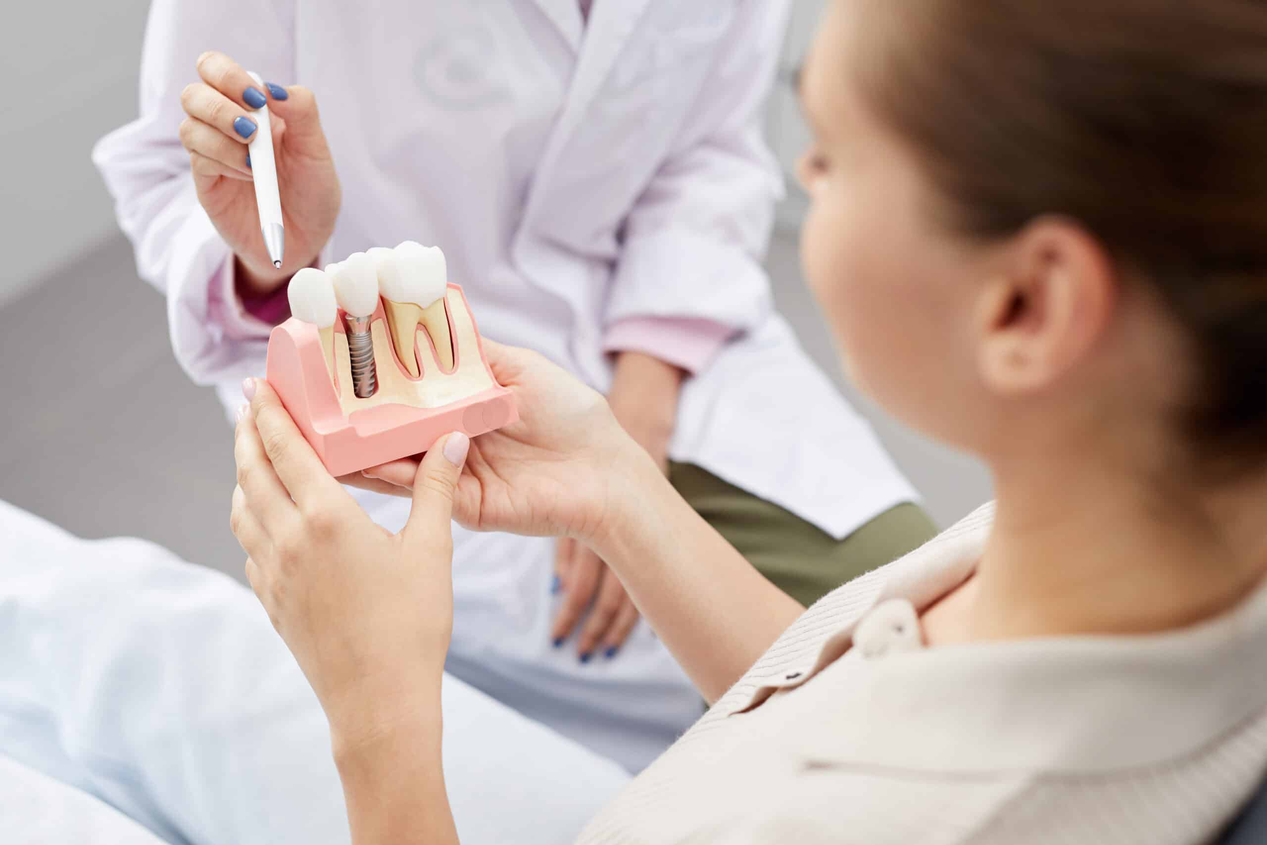 what-you-should-know-about-dental-implants