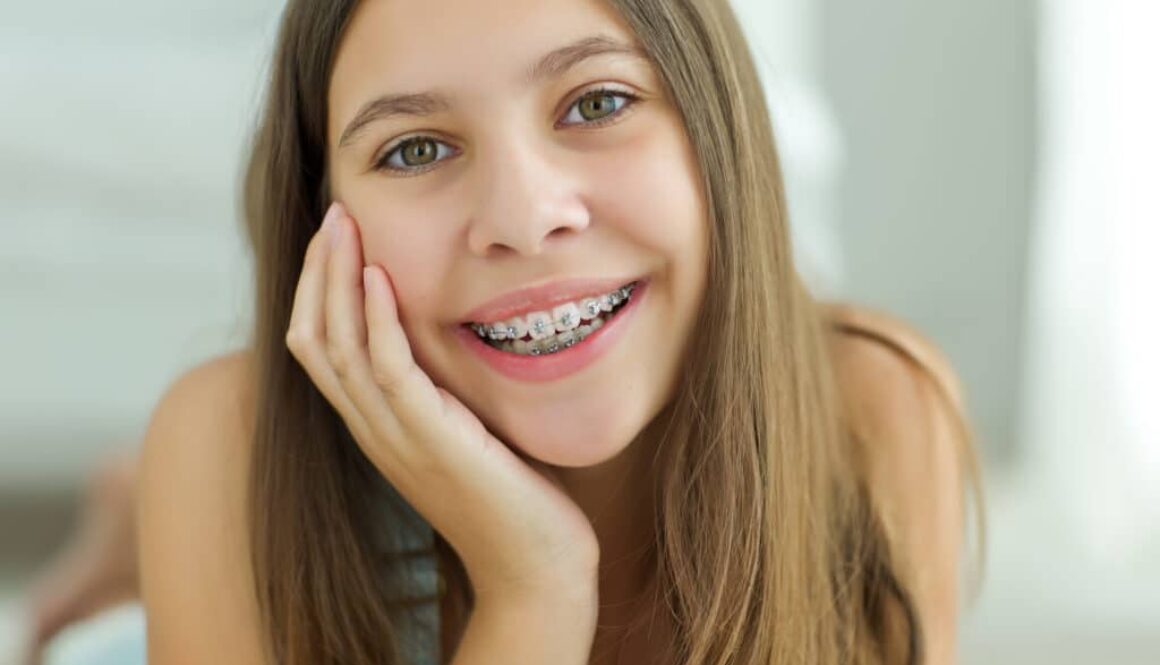 3-ways-you-can-straighten-your-teeth