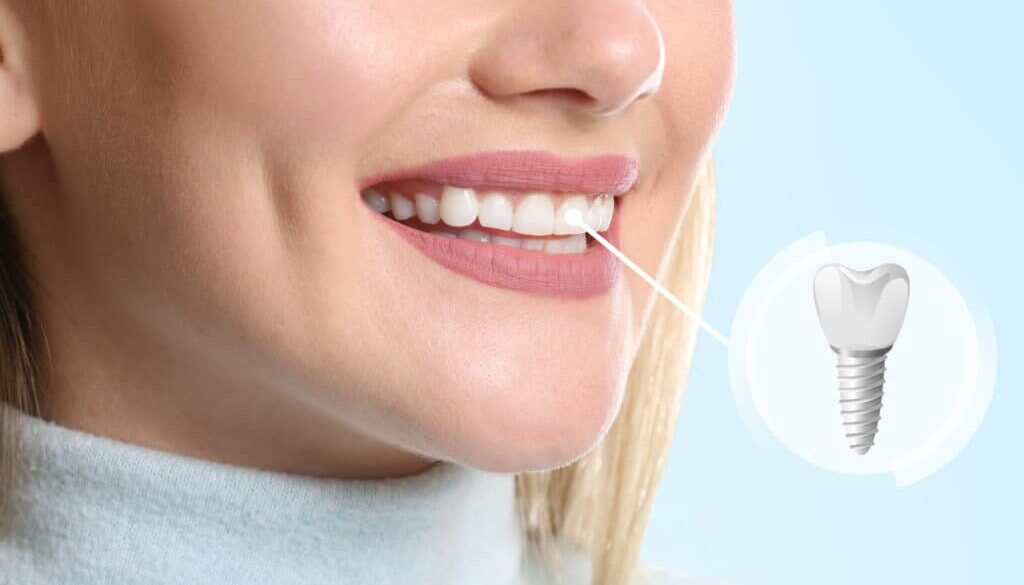 how-to-choose-the-right-tooth-replacement-option-for-you