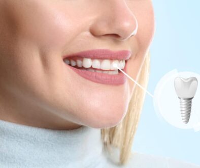 how-to-choose-the-right-tooth-replacement-option-for-you