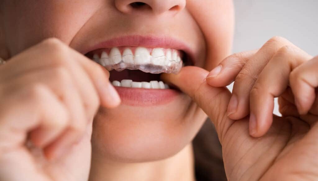 bruxism-your-dental-health