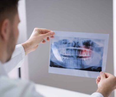 when-to-remove-wisdom-teeth-in-saratoga-springs