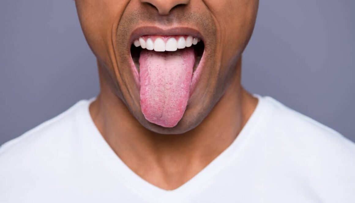 what-your-tongue-says-about-your-health