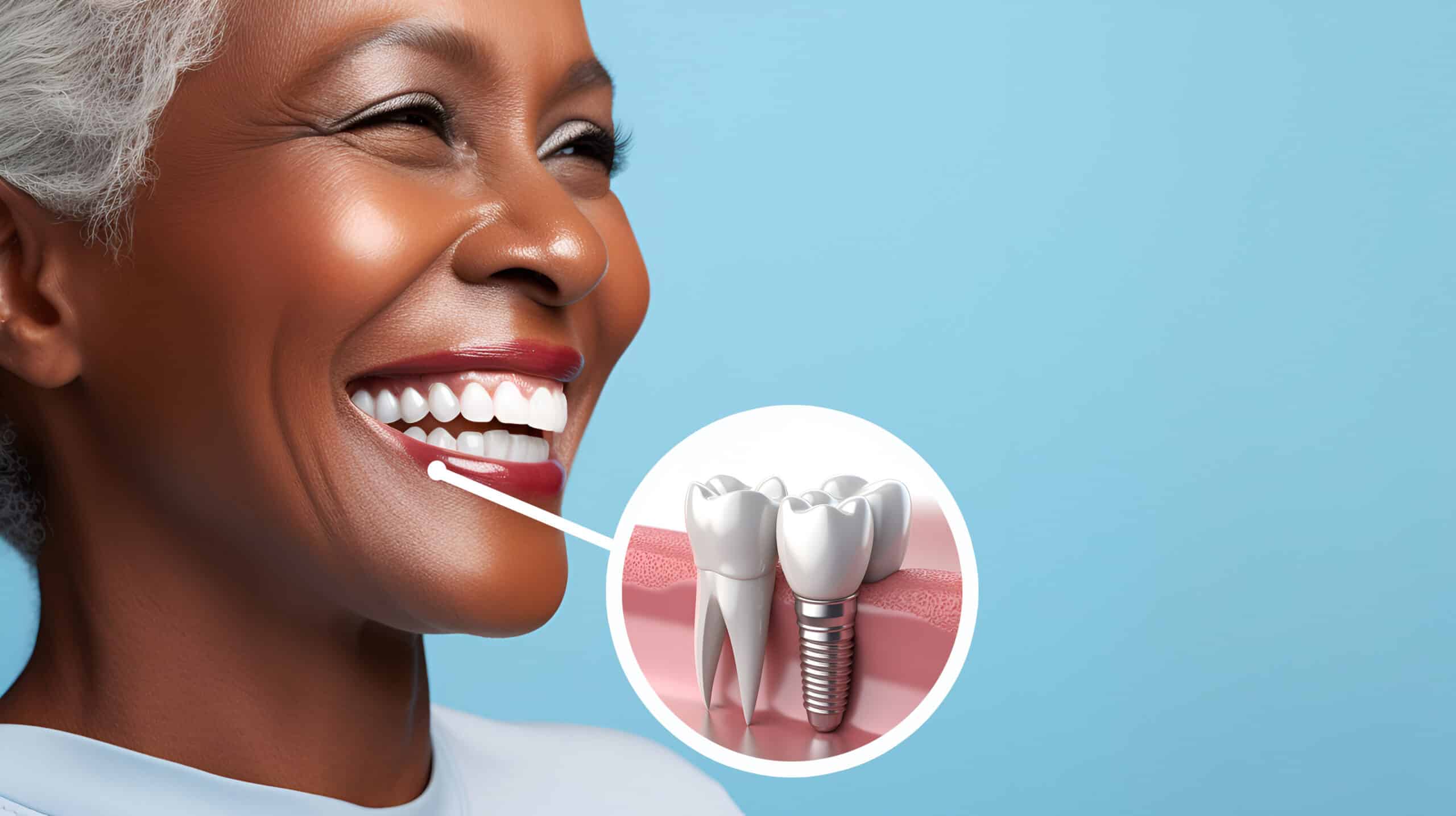 Why Replacing Missing Teeth Is About More Than Just Looks