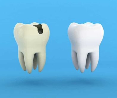 why-early-treatment-for-tooth-decay-matters-for-herriman-patients