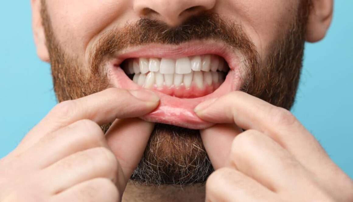 fresh-breath-starts-with-healthy-gums-in-highland