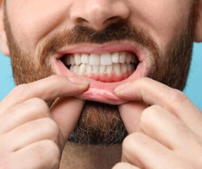 fresh-breath-starts-with-healthy-gums-in-highland